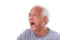 shocked, stunned, unhappy old man with surferÃ¢â¬â¢s eye or pterygium Royalty Free Stock Photo